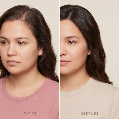 CapilRoot Pro - Recupera tu cabello y tu confianza en casa, sin químicos ni pastillas